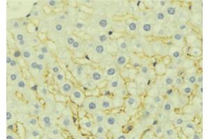 ABIN6277061 at 1/100 staining Mouse liver tissue by IHC-P. (EPHX1 抗体  (Internal Region))