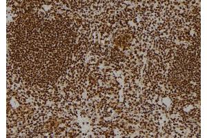 ABIN6269102 at 1/100 staining Mouse spleen tissue by IHC-P. (Progesterone Receptor 抗体)
