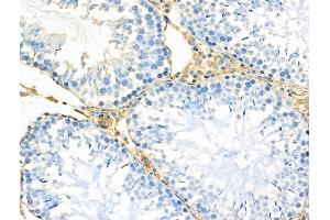 anti-Mitochondrial Import Receptor Subunit TOM20 homolog (TOMM20) (Internal Region) antibody