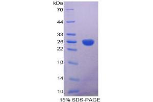 SDS-PAGE of Protein Standard from the Kit (Highly purified E. (Aconitase 1 ELISA 试剂盒)