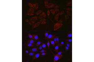 Immunofluorescence analysis of  cells using PMEL Rabbit pAb (ABIN7269510) at dilution of 1:100 (40x lens). (Melanoma gp100 抗体  (AA 25-300))