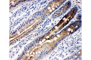 Anti-DDX4/MVH antibody, IHC(F) IHC(F): Rat Intestine Tissue (DDX4 抗体  (Middle Region))