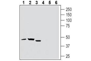 Western blot analysis of rat spleen lysate (lanes 1 and 4), rat brain lysate (lanes 2 and 5) and mouse brain lysate (lanes 3 and 6): - 1-3. (TBXA2R 抗体  (Extracellular, N-Term))