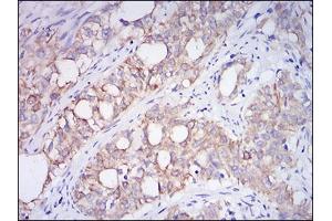 Immunohistochemistry (IHC) image for anti-Membrane Metallo-Endopeptidase (MME) (AA 52-246) antibody (ABIN1724914)