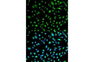 Immunofluorescence analysis of HeLa cell using WT1 antibody. (WT1 抗体  (AA 1-302))