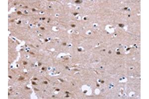 The image on the left is immunohistochemistry of paraffin-embedded Human brain tissue using ABIN7190847(GPR171 Antibody) at dilution 1/25, on the right is treated with synthetic peptide. (GPR171 抗体)