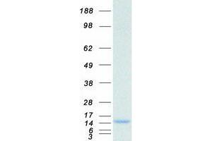 Validation with Western Blot
