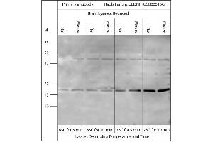 Western blot on brain lysates using Rabbit antibody to pro BDNF (50-90): . (Pro BDNF 抗体)