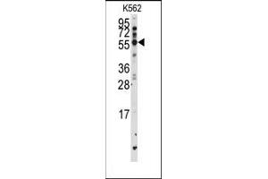 Image no. 1 for anti-Cytochrome P450, Family 2, Subfamily F, Polypeptide 1 (CYP2F1) (AA 402-432), (C-Term) antibody (ABIN360249) (CYP2F1 抗体  (C-Term))