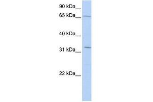 TRIM22 antibody used at 0. (TRIM22 抗体  (Middle Region))