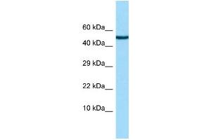WB Suggested Anti-CHRDL2 Antibody Titration: 1. (CHRDL2 抗体  (N-Term))