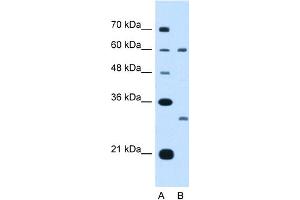 WB Suggested Anti-TSPAN32 Antibody Titration:  5. (TSPAN32 抗体  (Middle Region))