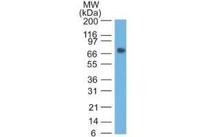 Western Blot analysis of human Stomach lysate using CEA Mouse Monoclonal Antibody (COL-1). (CEACAM5 抗体)