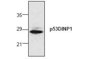 Image no. 1 for anti-Tumor Protein P53 Inducible Nuclear Protein 1 (TP53INP1) (N-Term) antibody (ABIN155075) (TP53INP1 抗体  (N-Term))