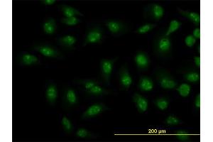 Immunofluorescence (IF) image for anti-SMAD, Mothers Against DPP Homolog 1 (SMAD1) (AA 1-465) antibody (ABIN517611)
