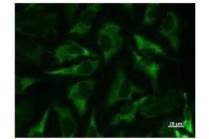 Immunostaining analysis in HeLa cells. (Mars (MARS) 抗体)