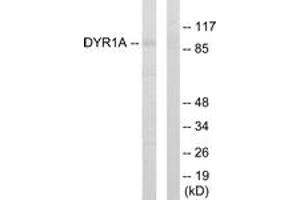 Western blot analysis of extracts from HepG2 cells, using DYR1A Antibody. (DYRK1A 抗体  (AA 21-70))