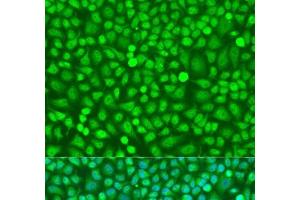Immunofluorescence analysis of U2OS cells using HOXB5 Polyclonal Antibody at dilution of 1:100. (HOXB5 抗体)