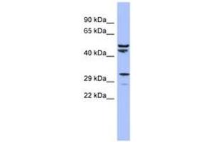 Image no. 1 for anti-Mitochondrial Ribosomal Protein S15 (MRPS15) (AA 35-84) antibody (ABIN6742891) (MRPS15 抗体  (AA 35-84))