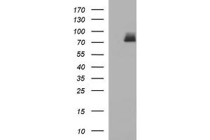 Western Blotting (WB) image for anti-Hydroxysteroid (17-Beta) Dehydrogenase 4 (HSD17B4) antibody (ABIN2715564) (HSD17B4 抗体)