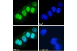 Immunofluorescence staining of fixed A431 with anti-p53 antibody PAb421. (Recombinant p53 抗体  (AA 371-380))