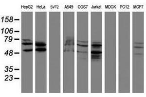 Image no. 2 for anti-SUMO1/sentrin/SMT3 Specific Peptidase 2 (SENP2) (AA 139-523) antibody (ABIN1490926) (SENP2 抗体  (AA 139-523))