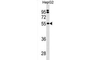 Western Blotting (WB) image for anti-Sep (O-phosphoserine) tRNA:Sec (Selenocysteine) tRNA Synthase (SEPSECS) antibody (ABIN3000193) (SEPSECS 抗体)