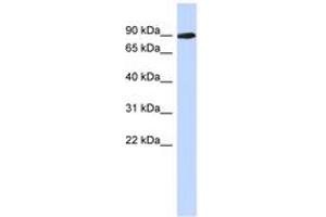 PGM2L1 抗体  (AA 179-228)