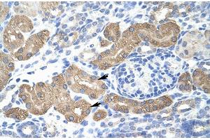 Rabbit Anti-L3MBTL2 Antibody Catalog Number: ARP30080 Paraffin Embedded Tissue: Human Kidney Cellular Data: Epithelial cells of renal tubule Antibody Concentration: 4. (L3MBTL2 抗体  (C-Term))