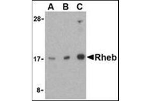 Western blot analysis of Rheb in mouse brain cell lysate with this product at (A) 1, (B) 2, and (C) 4 μg/ml. (RHEB 抗体  (Center))