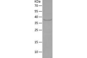 Western Blotting (WB) image for Fibroblast Growth Factor 22 (FGF22) (AA 23-170) protein (His-IF2DI Tag) (ABIN7122936) (FGF22 Protein (AA 23-170) (His-IF2DI Tag))