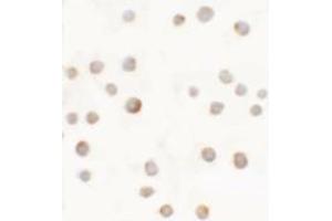 Immunocytochemistry of ABCA7 in 293 cells with ABCA7 antibody at 5 ug/mL. (ABCA7 抗体  (N-Term))