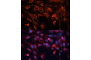 Immunofluorescence analysis of C6 cells using Cation-independent M6PR (Cation-independent M6PR (IGF2R)) antibody (ABIN6130063, ABIN6142247, ABIN6142248 and ABIN6216853) at dilution of 1:100. (IGF2R 抗体  (AA 2327-2491))