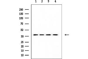 Western blot analysis of lysates from various samples, using HLA-G Mouse Monoclonal Antibody at 1/1000 dilution.