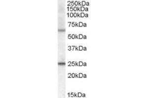 Image no. 1 for anti-Collagen, Type IV, alpha 3 (Goodpasture Antigen) Binding Protein (COL4A3BP) (Internal Region) antibody (ABIN374934) (COL4A3BP 抗体  (Internal Region))
