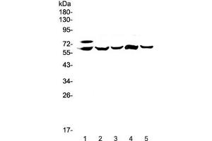 Western blot testing of 1) human HepG2, 2) rat liver, 3) rat lung, 4) mouse liver and 5) mouse lung lysate with Carboxylesterase 1 antibody at 0. (CES1 抗体)