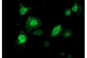 Immunofluorescence (IF) image for anti-Tubulin tyrosine Ligase-Like Family, Member 12 (TTLL12) antibody (ABIN1499030) (TTLL12 抗体)