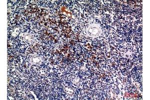 Immunohistochemistry (IHC) analysis of paraffin-embedded Human Tonsils, antibody was diluted at 1:100. (Syndecan 1 抗体  (Internal Region))