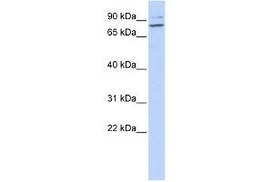 WB Suggested Anti-PLCD1 Antibody Titration: 0. (PLCD1 抗体  (N-Term))