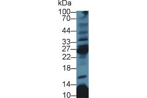 Western Blot; Sample: Rat Thymus lysate; Primary Ab: 3µg/ml Rabbit Anti-Human CD8b Antibody Second Ab: 0. (CD8B 抗体  (AA 22-170))