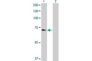 Western Blot analysis of CHEK2 expression in transfected 293T cell line by CHEK2 MaxPab polyclonal antibody. (CHEK2 抗体  (AA 1-543))