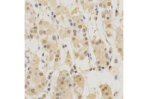 Immunohistochemistry of paraffin-embedded human stomach using PSMB5 antibody at dilution of 1:200 (x400 lens). (PSMB5 抗体  (AA 1-263))