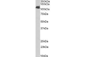 ABIN2613395 (1µg/ml) staining of Human Liver lysate (35µg protein in RIPA buffer). (BMPR2 抗体  (Internal Region))