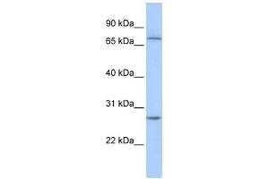 RCHY1 antibody used at 1 ug/ml to detect target protein. (RCHY1 抗体  (N-Term))