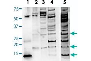 Western Blot analysis of (1) BDNF of rhBDNF R-088-100 (whole serum), (2) BDNF-isoform of rhBDNF R-088-100 (whole serum), (3) SHSY5Y of rhBDNF R-088-100 (whole serum), (4) Human brain of rhBDNF R-088-100 (whole serum), (5) Human brain of R-017-500 (IgG, 10 ug/mL), monomeric BDNF at 14 kDa and proBDNF is detected at the expected molecular weight of 32 kDa for glycosylated proBDNF monomer.