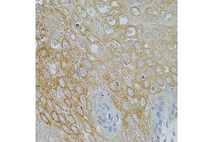 Immunohistochemistry of paraffin-embedded human esophagus using NTF3 antibody (ABIN5971628) at dilution of 1/100 (40x lens). (Neurotrophin 3 抗体)