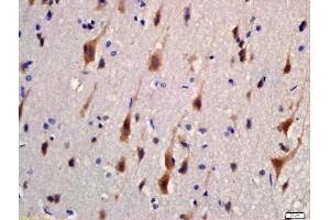 Formalin-fixed and paraffin embedded rat brain labeled with Rabbit Anti-KIBRA Polyclonal Antibody, Unconjugated (ABIN1387477) at 1:200 followed by conjugation to the secondary antibody and DAB staining (WWC1 抗体  (AA 351-450))