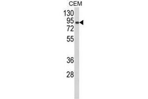 Western blot analysis of AOC3 Antibody (Center) in CEM cell line lysates (35ug/lane). (AOC3 抗体  (Middle Region))