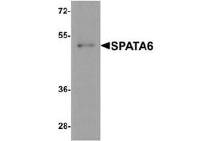 Western blot analysis of SPATA6 in A20 cell lysate with SPATA6 Antibody  at 1 µg/ml. (SPATA6 抗体  (C-Term))