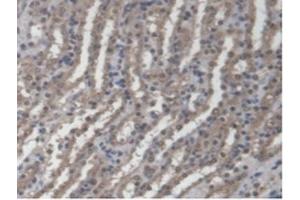 Immunohistochemistry (IHC) image for anti-Guanylate Binding Protein 4 (GBP4) (AA 1-304) antibody (ABIN7444514)